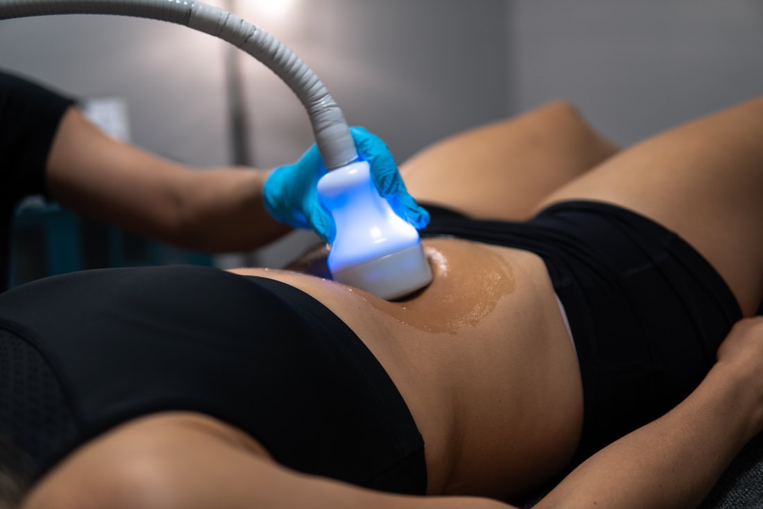 Cryoskin stomach slimming in just 30 minutes
